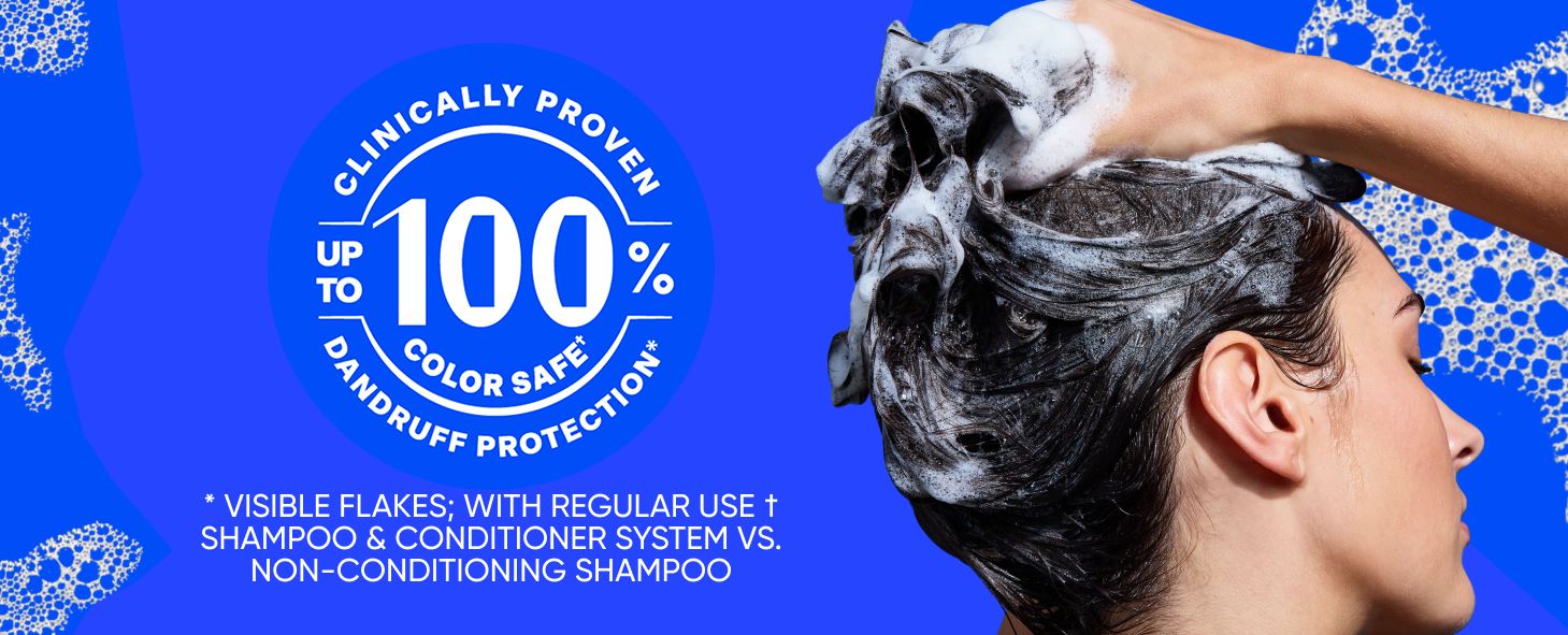 שמפו לטיפול בקרקפת יבשה