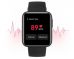 שעון חכם Xiaomi Mi Watch Lite שיאומי